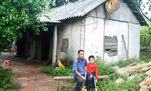 Bố nghèo nuôi con chấn thương sọ não