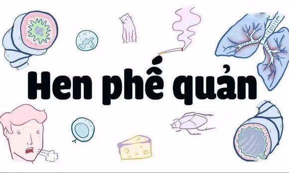 Cách nhận biết và xử trí cơn hen phế quản