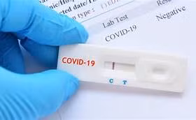 Test nhanh COVID 19